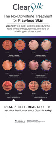 ClearSilk Retractable Banner Stand