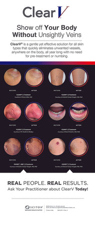 ClearV Retractable Banner Stand